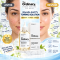 The Ordinary – Glycolic Acid 7% Toning Solution
